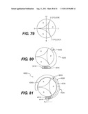 POST-OPERATIVE ADJUSTMENT TOOL, MINIMALLY INVASIVE ATTACHMENT APPARATUS,     AND ADJUSTABLE TRICUSPID RING diagram and image