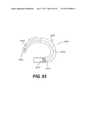 POST-OPERATIVE ADJUSTMENT TOOL, MINIMALLY INVASIVE ATTACHMENT APPARATUS,     AND ADJUSTABLE TRICUSPID RING diagram and image