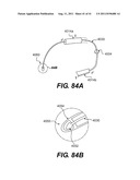 POST-OPERATIVE ADJUSTMENT TOOL, MINIMALLY INVASIVE ATTACHMENT APPARATUS,     AND ADJUSTABLE TRICUSPID RING diagram and image