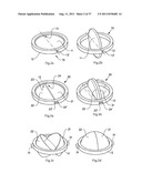 ARTIFICIAL VALVE diagram and image