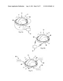 ARTIFICIAL VALVE diagram and image