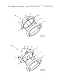 ARTIFICIAL VALVE diagram and image