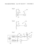 ARTIFICIAL VALVE diagram and image