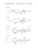 ARTIFICIAL VALVE diagram and image