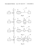 ARTIFICIAL STOMACH diagram and image