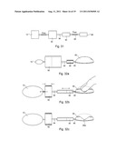 ARTIFICIAL STOMACH diagram and image