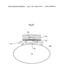 ARTIFICIAL STOMACH diagram and image