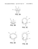 HEAT EXCHANGE STRUCTURE AND COOLING DEVICE COMPRISING SUCH A STRUCTURE diagram and image