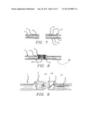 ACCESSORY SYSTEM FOR A GLIDE BOARD diagram and image