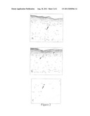 Compositions and Methods for the Treatment of Vitiligo diagram and image
