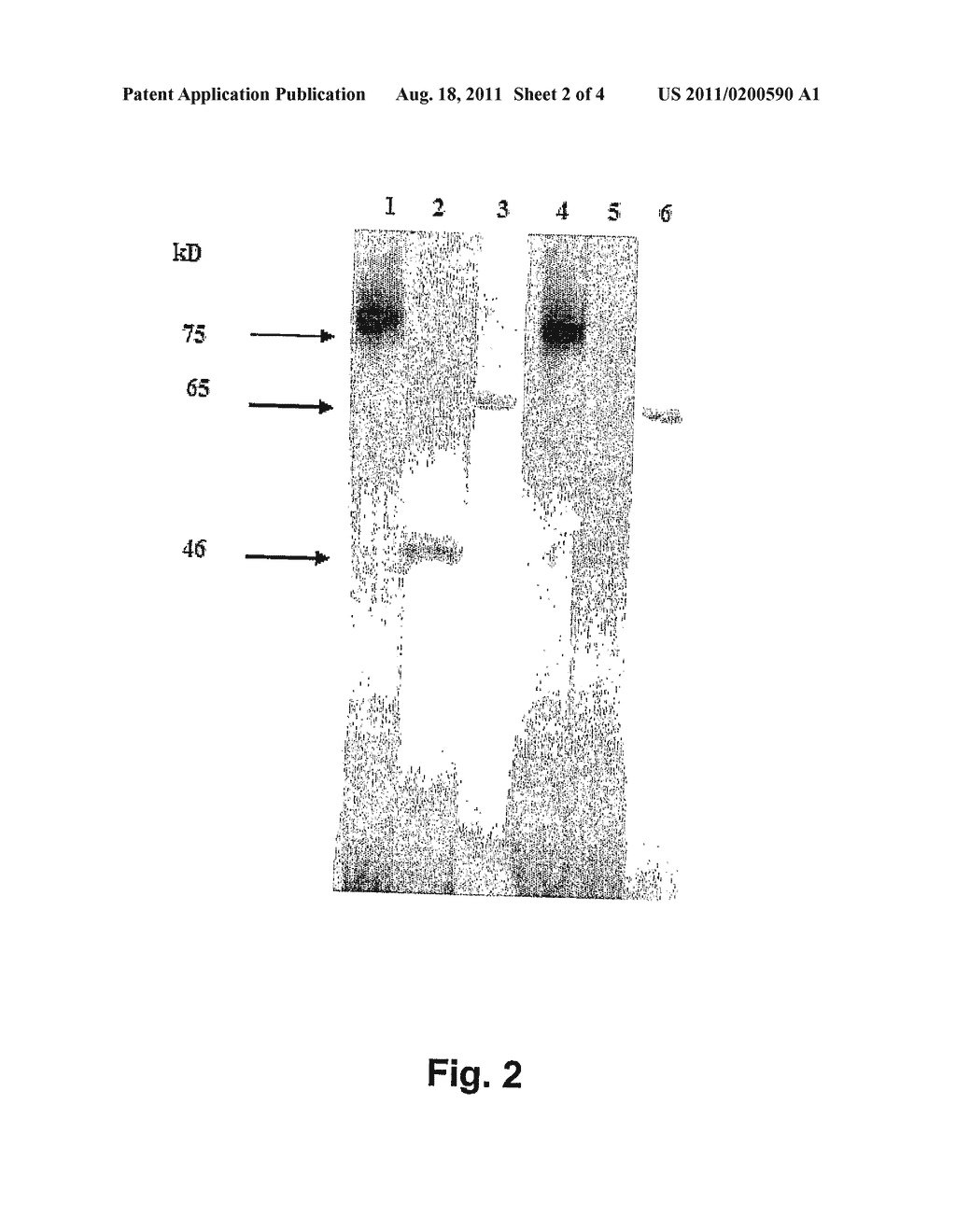 Antibodies Directed Against the Myelin Basic Protein Recognising an     Epitope of CD64 and Their Use as Immunosuppressants - diagram, schematic, and image 03