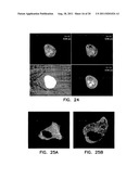 COMPOSITIONS COMPRISING A DEHALOGENASE SUBSTRATE AND A FLUORESCENT LABEL     AND METHODS OF USE diagram and image