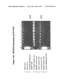 NUCLEIC ACIDS AND CORRESPONDING PROTEINS ENTITLED 202P5A5 USEFUL IN     TREATMENT AND DETECTION OF CANCER diagram and image