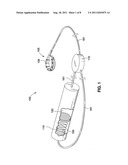 REMOTELY ADJUSTABLE GASTRIC BANDING SYSTEM diagram and image