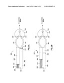 REMOTELY ADJUSTABLE GASTRIC BANDING SYSTEM diagram and image