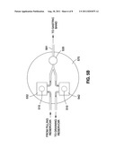 REMOTELY ADJUSTABLE GASTRIC BANDING SYSTEM diagram and image