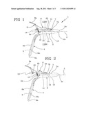 DEVICE FOR SURGICAL OPERATIONS ON A PROLAPSE diagram and image