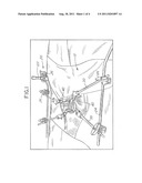 Retractor System for Anterior Cervical Spine Surgery diagram and image