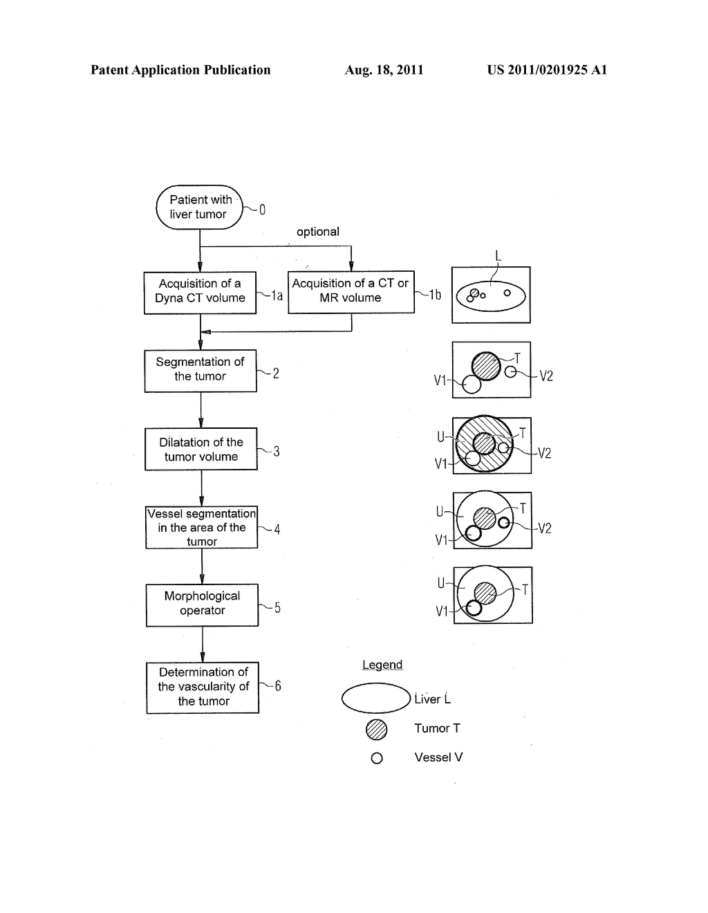 Method and Apparatus for Determining the Vascularity of an Object Located     in a Body - diagram, schematic, and image 02