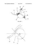 LOCAL EMBOLIZATION VIA HEATING OF THERMOSENSITIVE POLYMERS diagram and image