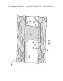 CATHETER DEPLYMENT DEVICE diagram and image