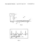 ULTRASOUND COMPATIBLE RADIOFREQUENCY ABLATION ELECTRODE diagram and image