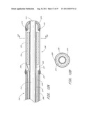 TREATMENT OF VASCULAR OCCLUSIONS USING ULTRASONIC ENERGY AND MICROBUBBLES diagram and image