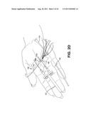 METHOD AND APPARATUS FOR REPAIRING A TENDON OR LIGAMENT diagram and image