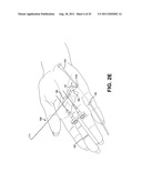 METHOD AND APPARATUS FOR REPAIRING A TENDON OR LIGAMENT diagram and image