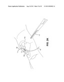 METHOD AND APPARATUS FOR REPAIRING A TENDON OR LIGAMENT diagram and image