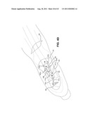 METHOD AND APPARATUS FOR REPAIRING A TENDON OR LIGAMENT diagram and image