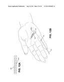 METHOD AND APPARATUS FOR REPAIRING A TENDON OR LIGAMENT diagram and image