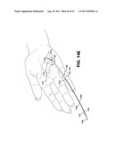 METHOD AND APPARATUS FOR REPAIRING A TENDON OR LIGAMENT diagram and image