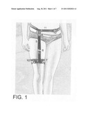 Catheter Leg Bag Support Device diagram and image