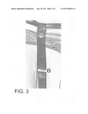 Catheter Leg Bag Support Device diagram and image