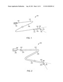 GUIDEWIRE POSITIONING DEVICE diagram and image