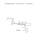 GUIDEWIRE POSITIONING DEVICE diagram and image