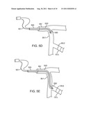 GUIDEWIRE POSITIONING DEVICE diagram and image