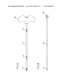 BONE CEMENT INJECTION NEEDLE diagram and image