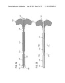 BONE CEMENT INJECTION NEEDLE diagram and image