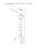 BONE CEMENT INJECTION NEEDLE diagram and image