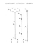 BONE CEMENT INJECTION NEEDLE diagram and image