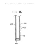 BONE CEMENT INJECTION NEEDLE diagram and image