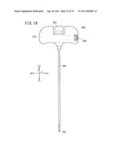 BONE CEMENT INJECTION NEEDLE diagram and image