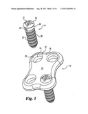 NON-METALLIC IMPLANT DEVICES AND INTRA-OPERATIVE METHODS FOR ASSEMBLY AND     FIXATION diagram and image