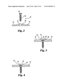 NON-METALLIC IMPLANT DEVICES AND INTRA-OPERATIVE METHODS FOR ASSEMBLY AND     FIXATION diagram and image