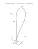 Apparatus and Methods for Creating a Venous Valve from Autologous Tissue diagram and image