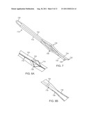 Apparatus and Methods for Creating a Venous Valve from Autologous Tissue diagram and image