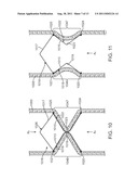 Apparatus and Methods for Creating a Venous Valve from Autologous Tissue diagram and image