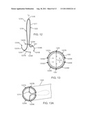 Apparatus and Methods for Creating a Venous Valve from Autologous Tissue diagram and image